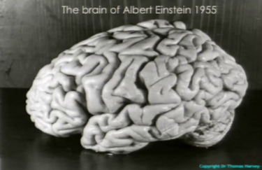 Einstein's Brain