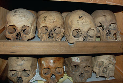 Dr. Morton's Skull Collection